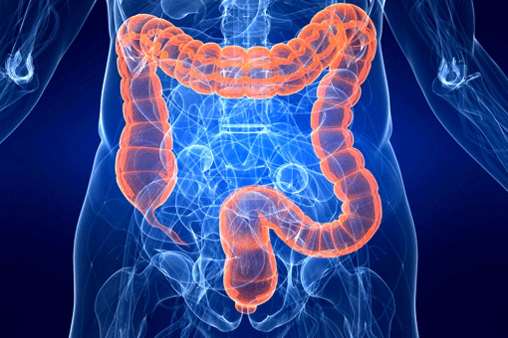 Il tumore del colon retto sintomi, cause e trattamento Il tumore del colon retto sintomi, cause e trattamento